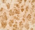 MAPPA_BURL_1501_01.jpg